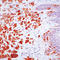 Melan-A antibody, LS-C88398, Lifespan Biosciences, Immunohistochemistry paraffin image 