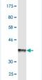 ATP Binding Cassette Subfamily B Member 6 (Langereis Blood Group) antibody, H00010058-M01, Novus Biologicals, Western Blot image 