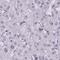 Nuclear Autoantigenic Sperm Protein antibody, PA5-56493, Invitrogen Antibodies, Immunohistochemistry frozen image 
