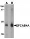 Calcium Release Activated Channel Regulator 2B antibody, TA320157, Origene, Western Blot image 