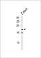 POD1 antibody, PA5-72640, Invitrogen Antibodies, Western Blot image 