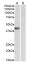 Leukocyte elastase inhibitor A antibody, orb178385, Biorbyt, Western Blot image 