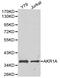 Aldo-Keto Reductase Family 1 Member A1 antibody, LS-C192341, Lifespan Biosciences, Western Blot image 