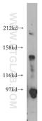 Cadherin 2 antibody, 13769-1-AP, Proteintech Group, Western Blot image 