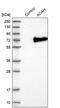 Acyloxyacyl Hydrolase antibody, PA5-55390, Invitrogen Antibodies, Western Blot image 