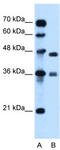 N-Methylpurine DNA Glycosylase antibody, TA336087, Origene, Western Blot image 