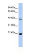 Single Stranded DNA Binding Protein 4 antibody, orb329861, Biorbyt, Western Blot image 