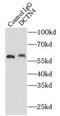 Dynactin Subunit 4 antibody, FNab02274, FineTest, Immunoprecipitation image 