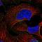 Ras-related protein Rab-5C antibody, HPA004167, Atlas Antibodies, Immunofluorescence image 
