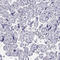 Cone-Rod Homeobox antibody, HPA036762, Atlas Antibodies, Immunohistochemistry frozen image 
