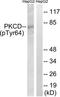 Protein kinase C delta type antibody, TA312520, Origene, Western Blot image 