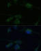 Von Hippel-Lindau Tumor Suppressor antibody, 13-158, ProSci, Immunofluorescence image 