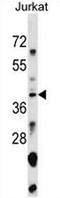 Small Nuclear RNA Activating Complex Polypeptide 1 antibody, AP53957PU-N, Origene, Western Blot image 