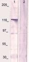 FMS antibody, TA354663, Origene, Western Blot image 