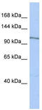 Mitogen-activated protein kinase kinase kinase kinase 4 antibody, TA330965, Origene, Western Blot image 