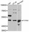 ECPTP antibody, LS-C747396, Lifespan Biosciences, Western Blot image 