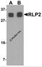 RILP-like protein 2 antibody, 6799, ProSci, Western Blot image 