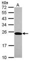 Nucleoside-Triphosphatase, Cancer-Related antibody, GTX116960, GeneTex, Western Blot image 