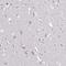 Glucuronic Acid Epimerase antibody, PA5-61688, Invitrogen Antibodies, Immunohistochemistry paraffin image 
