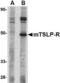 Cytokine receptor-like factor 2 antibody, TA306427, Origene, Western Blot image 