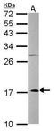 NADH:Ubiquinone Oxidoreductase Subunit A12 antibody, TA308291, Origene, Western Blot image 