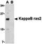 NFKB Inhibitor Interacting Ras Like 2 antibody, orb74458, Biorbyt, Western Blot image 