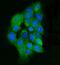 Integrin-linked protein kinase antibody, A02932-3, Boster Biological Technology, Immunofluorescence image 