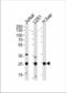 Glutathione S-Transferase Mu 1 antibody, TA324877, Origene, Western Blot image 