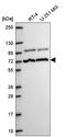 Mediator Complex Subunit 25 antibody, HPA068802, Atlas Antibodies, Western Blot image 