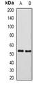 SUFU Negative Regulator Of Hedgehog Signaling antibody, orb341171, Biorbyt, Western Blot image 