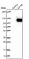Cap Methyltransferase 1 antibody, NBP1-83048, Novus Biologicals, Western Blot image 