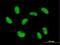 Zinc Finger Protein 468 antibody, H00090333-B01P, Novus Biologicals, Immunocytochemistry image 