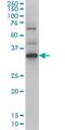 Zic Family Member 4 antibody, H00084107-M01, Novus Biologicals, Western Blot image 