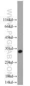 KLRC1 antibody, 10935-1-AP, Proteintech Group, Western Blot image 