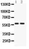 Barkor antibody, PB9481, Boster Biological Technology, Western Blot image 