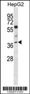 Nei Like DNA Glycosylase 2 antibody, 58-223, ProSci, Western Blot image 