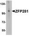 Zinc Finger Protein 281 antibody, A07538, Boster Biological Technology, Western Blot image 