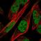 Zinc Finger Protein 594 antibody, HPA069360, Atlas Antibodies, Immunocytochemistry image 
