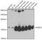 Nudix Hydrolase 2 antibody, GTX32760, GeneTex, Western Blot image 