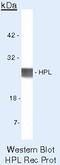 Chorionic somatomammotropin hormone antibody, PA5-16805, Invitrogen Antibodies, Western Blot image 
