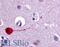 Cholinergic Receptor Muscarinic 3 antibody, LS-A1423, Lifespan Biosciences, Immunohistochemistry paraffin image 