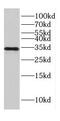 Centromere Protein O antibody, FNab01590, FineTest, Western Blot image 