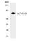 ENaCD antibody, LS-B14698, Lifespan Biosciences, Western Blot image 