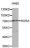 Nuclear receptor ROR-alpha antibody, abx005288, Abbexa, Western Blot image 
