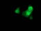 Catenin Beta 1 antibody, LS-C172580, Lifespan Biosciences, Immunofluorescence image 
