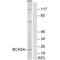 Breast Carcinoma Amplified Sequence 4 antibody, A13963, Boster Biological Technology, Western Blot image 