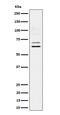 Bridging Integrator 1 antibody, M01551-3, Boster Biological Technology, Western Blot image 