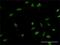 Myoneurin antibody, H00055892-M02, Novus Biologicals, Immunocytochemistry image 