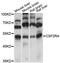 Colony Stimulating Factor 2 Receptor Alpha Subunit antibody, LS-C748242, Lifespan Biosciences, Western Blot image 