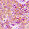 EGFR antibody, LS-C356019, Lifespan Biosciences, Immunohistochemistry frozen image 